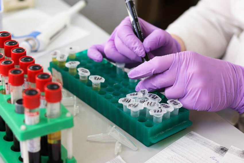 Man is writting names on samples to know who they belong to